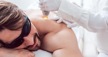 Man getting shoulder laser hair removal